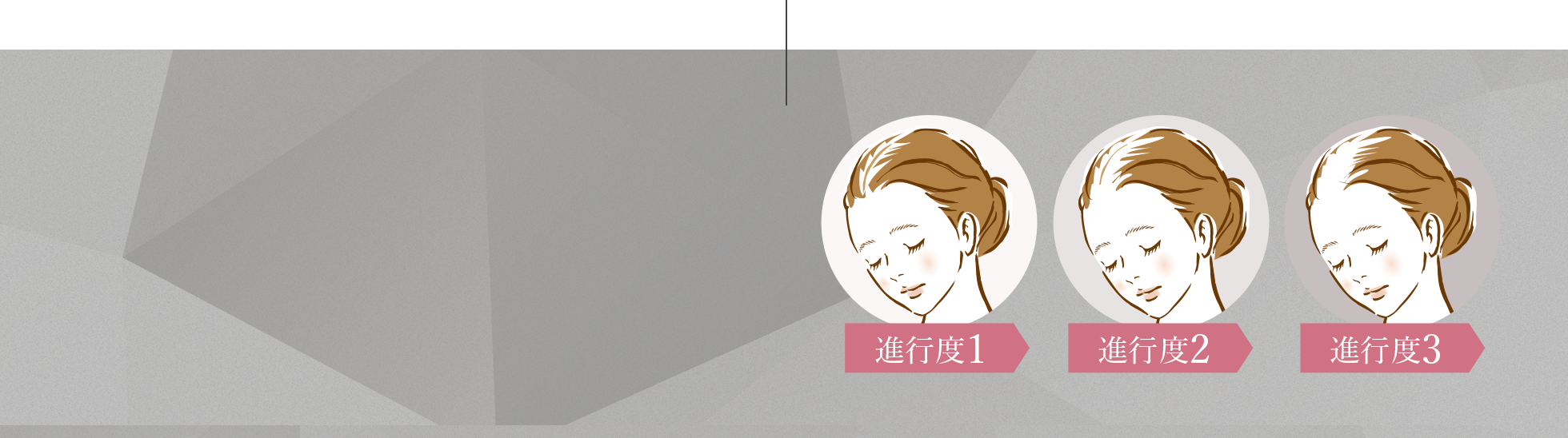 進行度1 進行度2 進行度3
